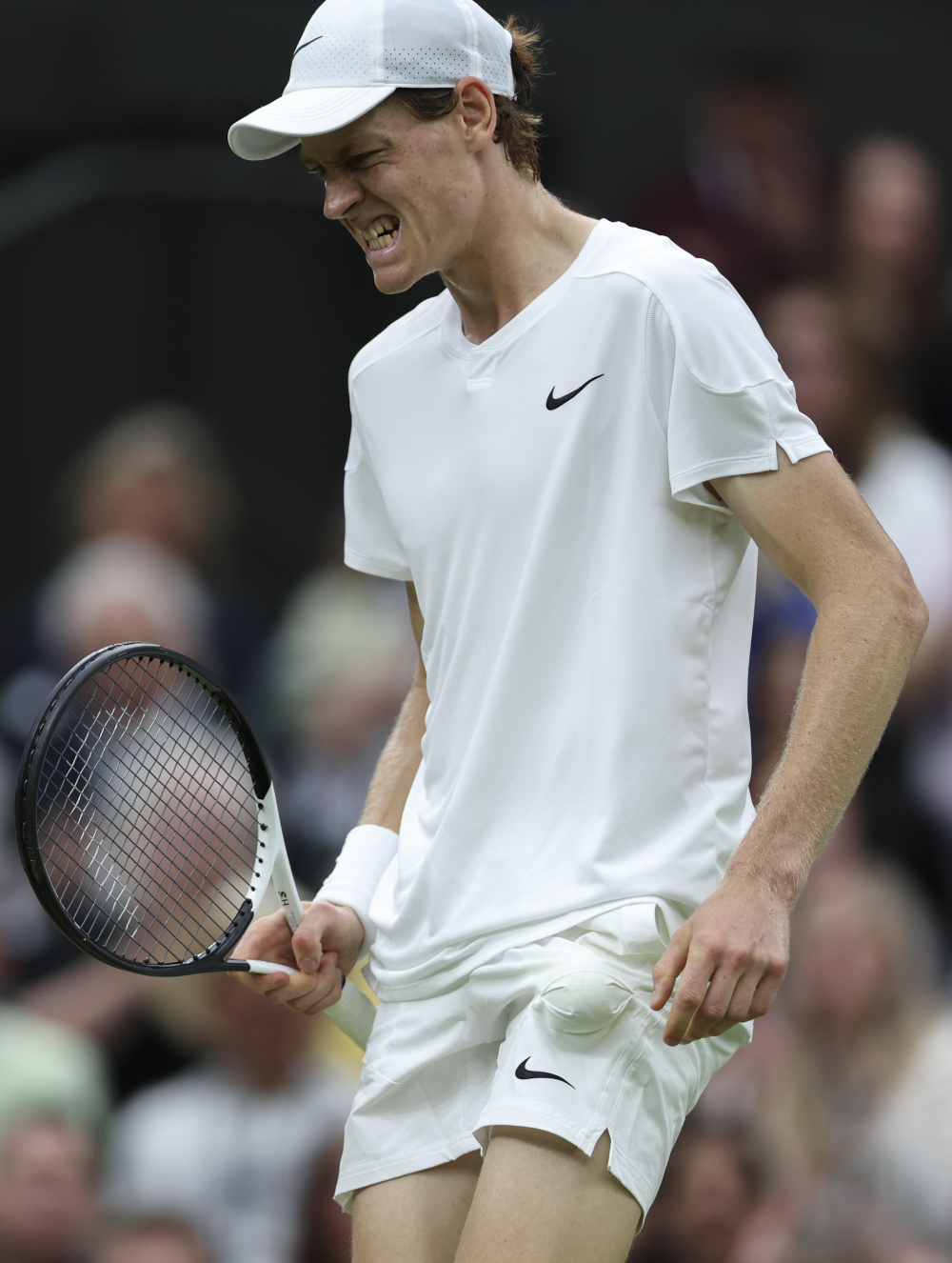 正阵容缺陷 正阵容缺陷